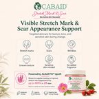 CABAID infographic showing stretch mark appearance, scar appearance, wrinkles, uneven texture, sensitive-skin-minded care, and no added fragrance